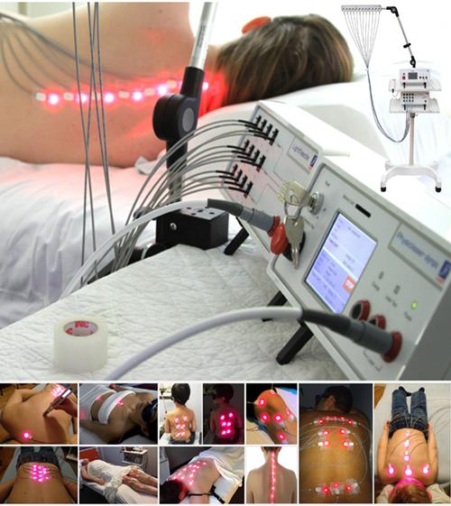 LightNeedle, Laser Needle